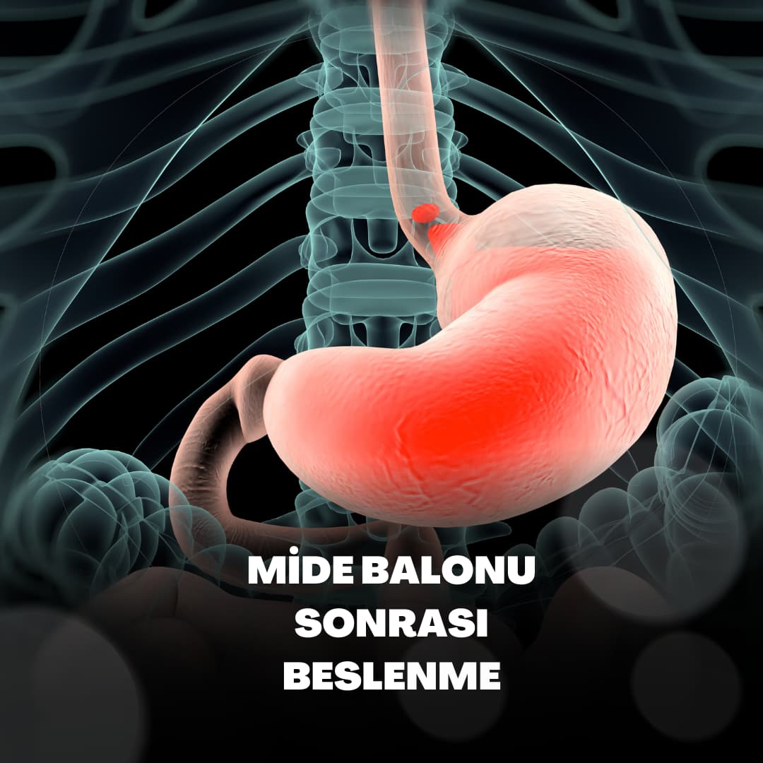 mide balonu sonrasi beslenme1