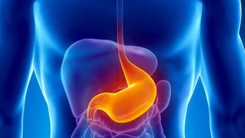 Tüp Mide Ameliyatı Sonrası Mide Yanması