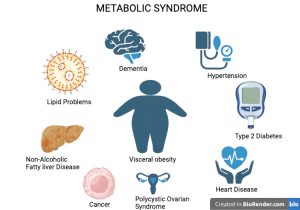 Metabolik Sendrom