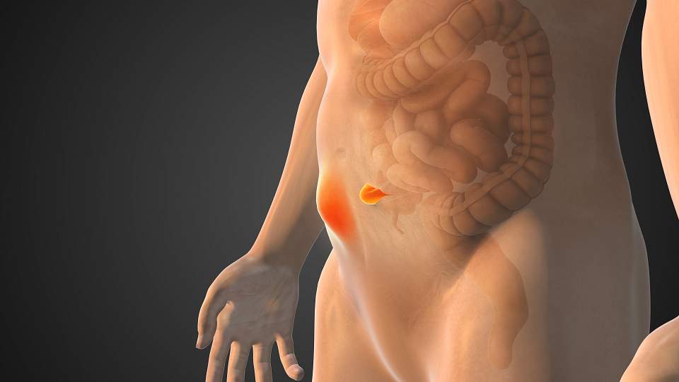 Obezite ve Karın Duvarı Fıtıkları: Cerrahi Müdahale Ne Zaman Yapılmalı? - Op. Dr. Güven Görkem